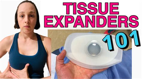 breast expansion meaning|How Tissue Expanders Are Used in Breast。